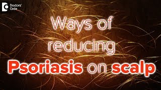 Scalp psoriasisSymptom Cause Treatment  Safe ways to Wash Hair Dr Rasya Dixit Doctors Circle [upl. by Bibby]