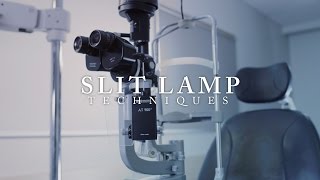 Ophthalmology Slit Lamp Techniques ubcmedicine [upl. by Nnep]