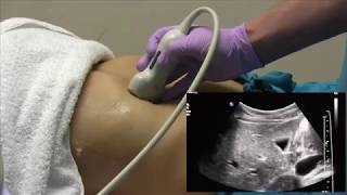 How I do it Ultrasound of the Abdomen [upl. by Lissy]