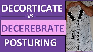 Decerebrate vs Decorticate Posturing Rigidity Mnemonic amp Pictures Nursing NCLEX [upl. by Gorski]