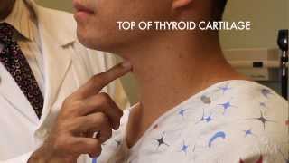 The Thyroid Exam Stanford Medicine 25 [upl. by Roderic744]