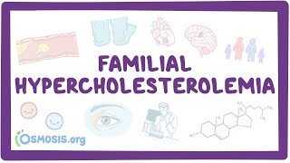 Types of Hyperlipidemia I–V – Cardiovascular Pathology  Lecturio [upl. by Amehsyt]