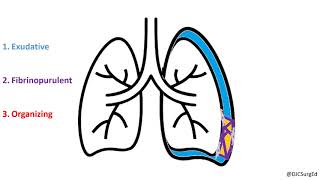 Pleura  Pleural Cavity anatomy [upl. by Vincents10]