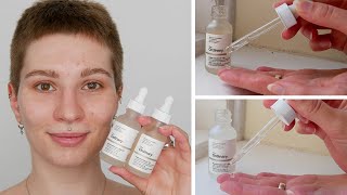 How to use The Ordinary Alpha Arbutin and Niacinamide together [upl. by Fitalludba]