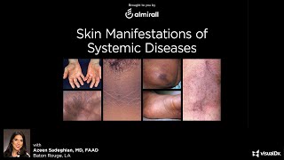 Skin Manifestations of Systemic Disease  November 5 2020 [upl. by Orran]