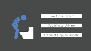 Trouble Urinating What Causes Urinary Issues in Men [upl. by Linsk]