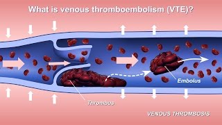 Embryology  Development of Vascular System [upl. by Akirej]