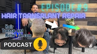 Hair Transplant Network Podcast Ep 9 Hair Transplant Repairs and Live QampA Dr Sergio Camacho [upl. by Colvin922]