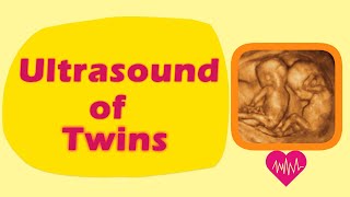 Sonography of Twins [upl. by Orabelle]