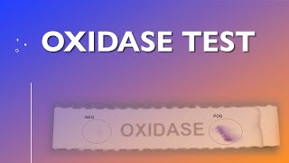 Oxidase Test [upl. by Anneg]