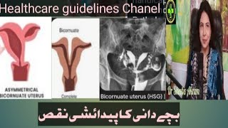 BICORNUATE UTERUS [upl. by Bettencourt]