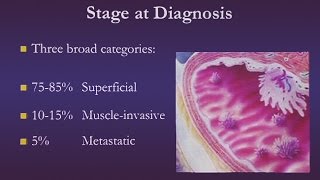 Bladder Cancer [upl. by Pain]