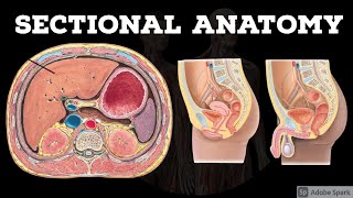 Sectional Anatomy  Abdomen  Pelvis  Anatomy Decoded [upl. by Nickles505]