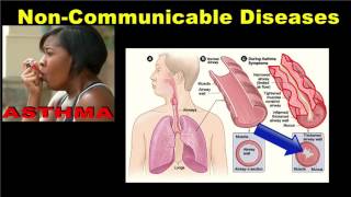 Noncommunicable Diseases [upl. by Inalaek]