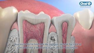 ¿Qué es Caries Dental   Oral B LT [upl. by Hulbert]