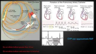 Hemodynamic Monitoring Part 1 [upl. by Ancelin]