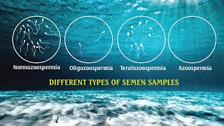 Semen analysis Samples OLIGOZOOSPERMIA ASTHENOZOOSPERMIA  TERATOZOOSPERMIA SPERM COUNT [upl. by Ariom903]