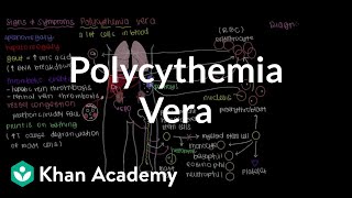 What is polycythemia vera  Hematologic System Diseases  NCLEXRN  Khan Academy [upl. by Henrieta258]