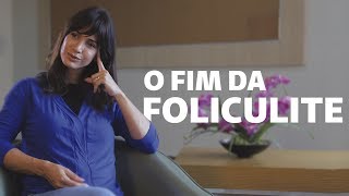 3 dicas infalíveis para evitar a foliculite  Viver Bem [upl. by Darryn434]