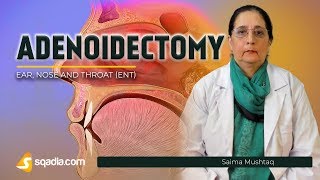 Tonsillectomy amp Adenoidectomy TampA Rated G [upl. by Acceb]