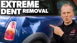 Extreme Dent Removal [upl. by Noguchi]