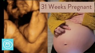 31 Weeks Pregnant What You Need To Know  Channel Mum [upl. by Yelahs]